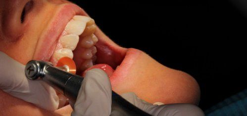 Estética dental