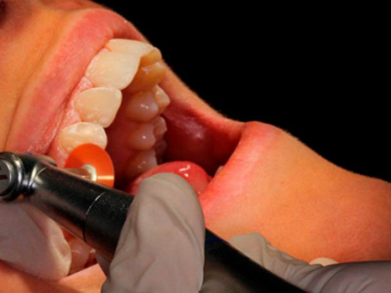 estetica dental vila real