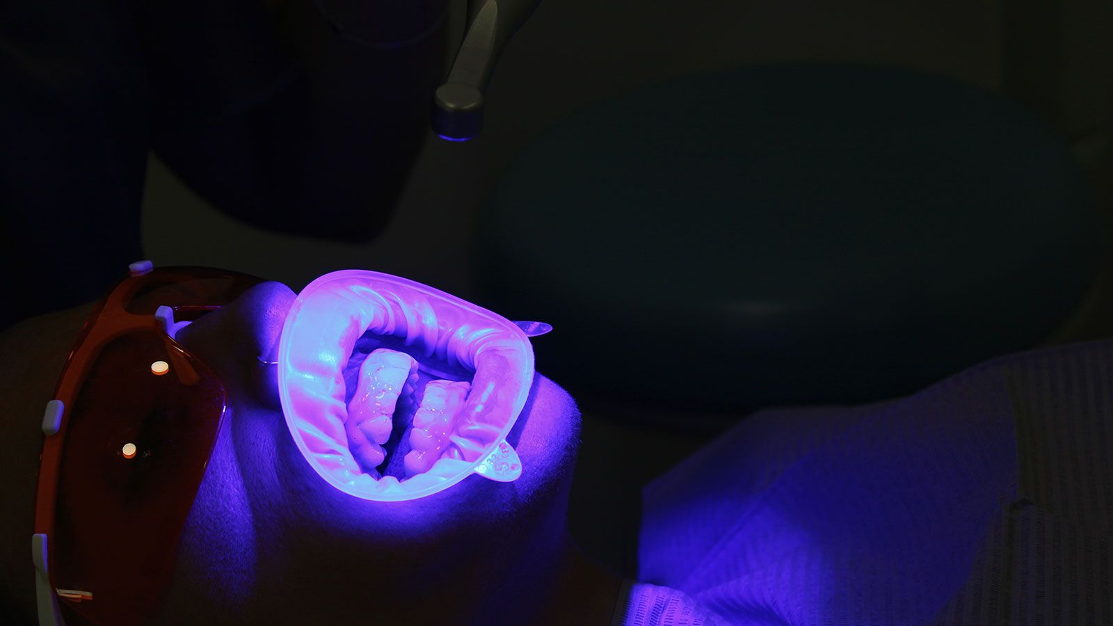 Blanqueamiento dental