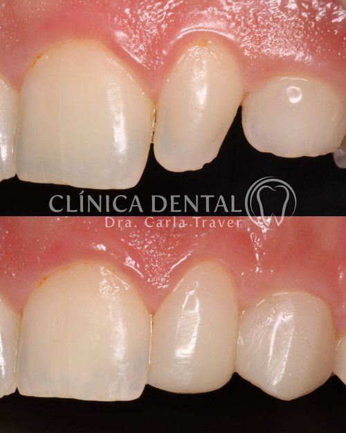 RECONSTRUCCIONES ESTÉTICAS