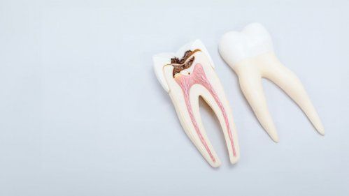 Odontología conservadora